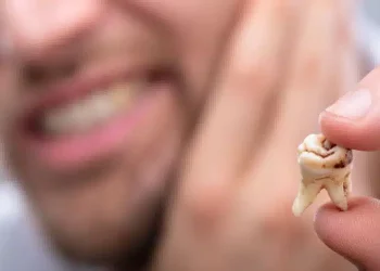 What Are the Early Symptoms of Cavities? How to Effectively Prevent and Treat Tooth Decay?