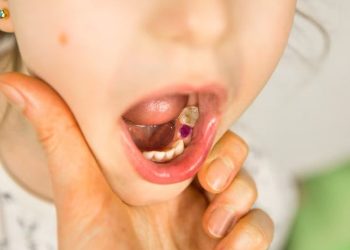 How Gum Disease Can Impact Your Overall Health: How Should You Respond?
