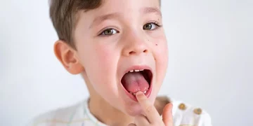 Do You Know How to Prevent Cavities and Gum Issues Through Daily Care?