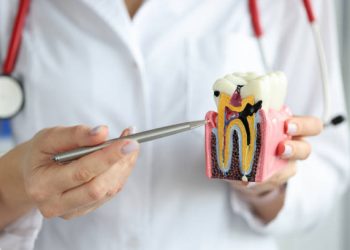 How to Reduce the Risk of Cavities Through Daily Oral Care