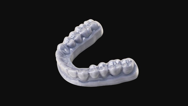 How Widely Is 3D Printing Used in Dentistry? The Benefits It Brings to Patients