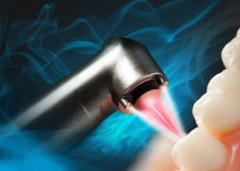 Is Laser Dentistry Safe? What Dental Issues Can It Treat?