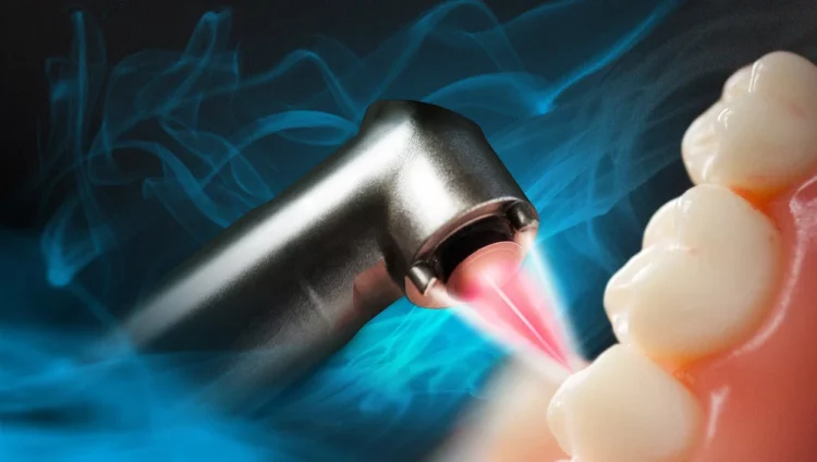 Is Laser Dentistry Safe? What Dental Issues Can It Treat?