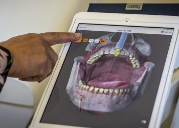 3D Printing for Dental Restoration: Process and Advantages Over Traditional Methods