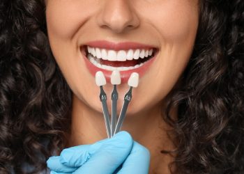 How Do You Choose the Right Dental Crown Material for Your Smile?