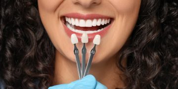How Do You Choose the Right Dental Crown Material for Your Smile?