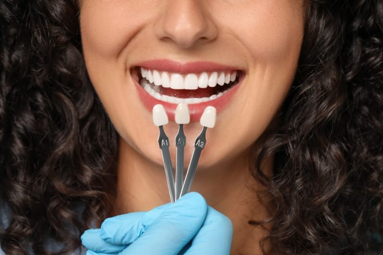 How Do You Choose the Right Dental Crown Material for Your Smile?