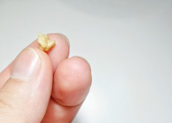 Bad Breath Causes Beyond Oral Hygiene