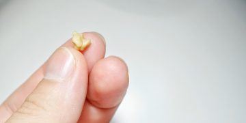 Bad Breath Causes Beyond Oral Hygiene