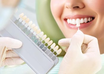How Teeth Whitening Works: Laser vs At-Home Methods