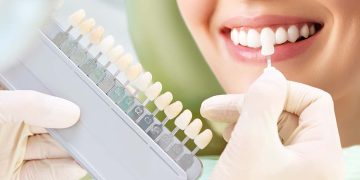 How Teeth Whitening Works: Laser vs At-Home Methods