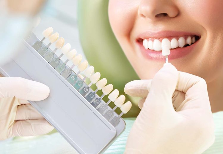 How Teeth Whitening Works: Laser vs At-Home Methods
