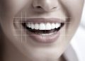 The Art of Smile Design: Balancing Symmetry and Personality