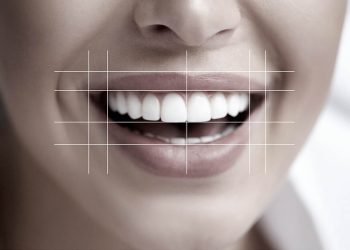 The Art of Smile Design: Balancing Symmetry and Personality