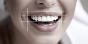The Art of Smile Design: Balancing Symmetry and Personality