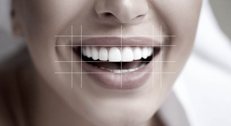 The Art of Smile Design: Balancing Symmetry and Personality