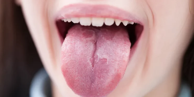 What Is Your Tongue Trying to Tell You About Your Health?
