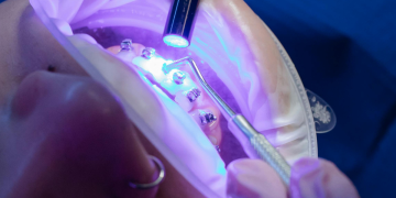 Future Innovations in Implant Dentistry