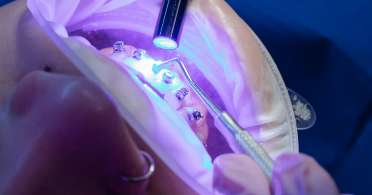 Future Innovations in Implant Dentistry