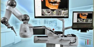 How Is Robotics Transforming the Future of Oral Surgery?