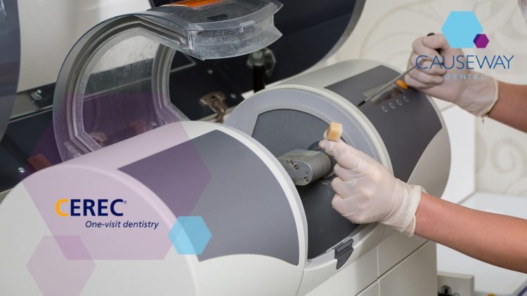 The Rise of Chairside CAD/CAM Systems