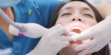The Stages of Gum Disease and When to Worry
