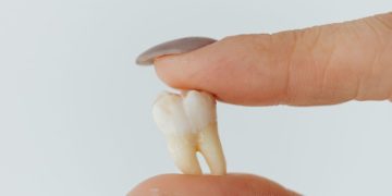 Are Your Dental Fillings Working With Your Body or Against It? The Rise of Biocompatible Dental Materials