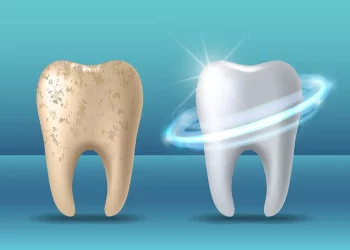 Can You Reverse Enamel Erosion Naturally?