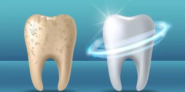 Can You Reverse Enamel Erosion Naturally?