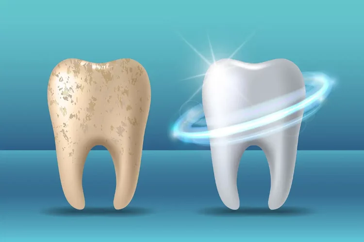 Can You Reverse Enamel Erosion Naturally?