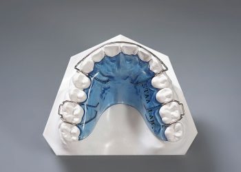 The Final, Most Important Step: Why Your Retainer is the True Key to Long-Term Orthodontic Success