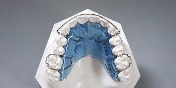 The Final, Most Important Step: Why Your Retainer is the True Key to Long-Term Orthodontic Success