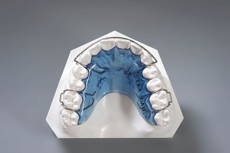 The Final, Most Important Step: Why Your Retainer is the True Key to Long-Term Orthodontic Success