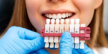 Is Your Age the Secret Factor in Your Smile Makeover? How Aging Redefines Cosmetic Dental Options