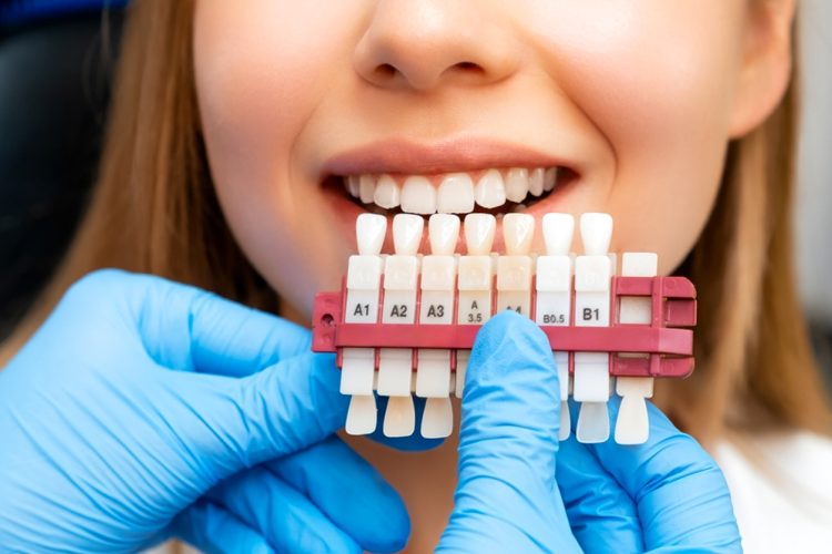 Is Your Age the Secret Factor in Your Smile Makeover? How Aging Redefines Cosmetic Dental Options