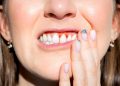 The Silent Attack: How Your Favorite Drink Is Dissolving Your Teeth