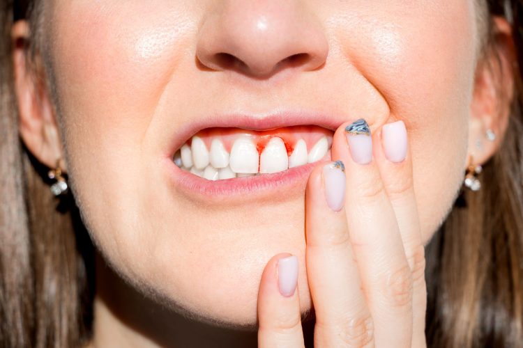 The Silent Attack: How Your Favorite Drink Is Dissolving Your Teeth