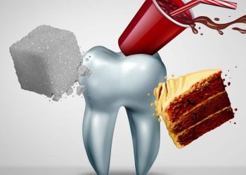 How Does the Timing of Your Meals Influence Your Risk of Cavities?