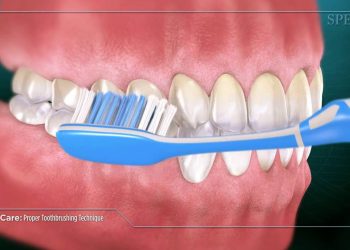 Are You Damaging Your Gums While Brushing? Common Brushing Mistakes Explained
