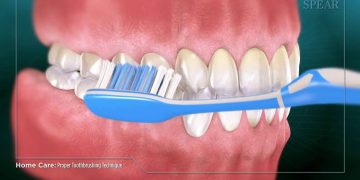 Are You Damaging Your Gums While Brushing? Common Brushing Mistakes Explained