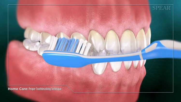 Are You Damaging Your Gums While Brushing? Common Brushing Mistakes Explained